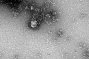 Роспотребнадзор: в России выявили 78 случаев заболевания британским штаммом коронавируса. У 23 пациентов — неопознанная мутация вируса
