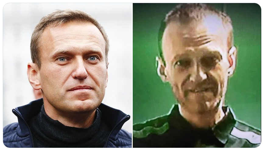 Видели фото истощенного Навального из колонии?. «Бумага»